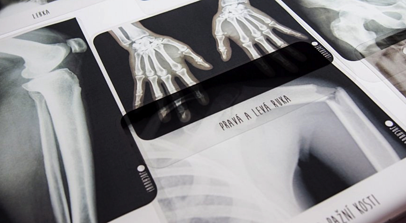 aktivity světelný panek - rentgenový snímek lidského těla